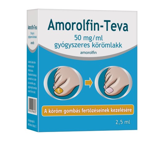 Amorolfin-Teva 50mg/ml gyógyszeres körömlakk